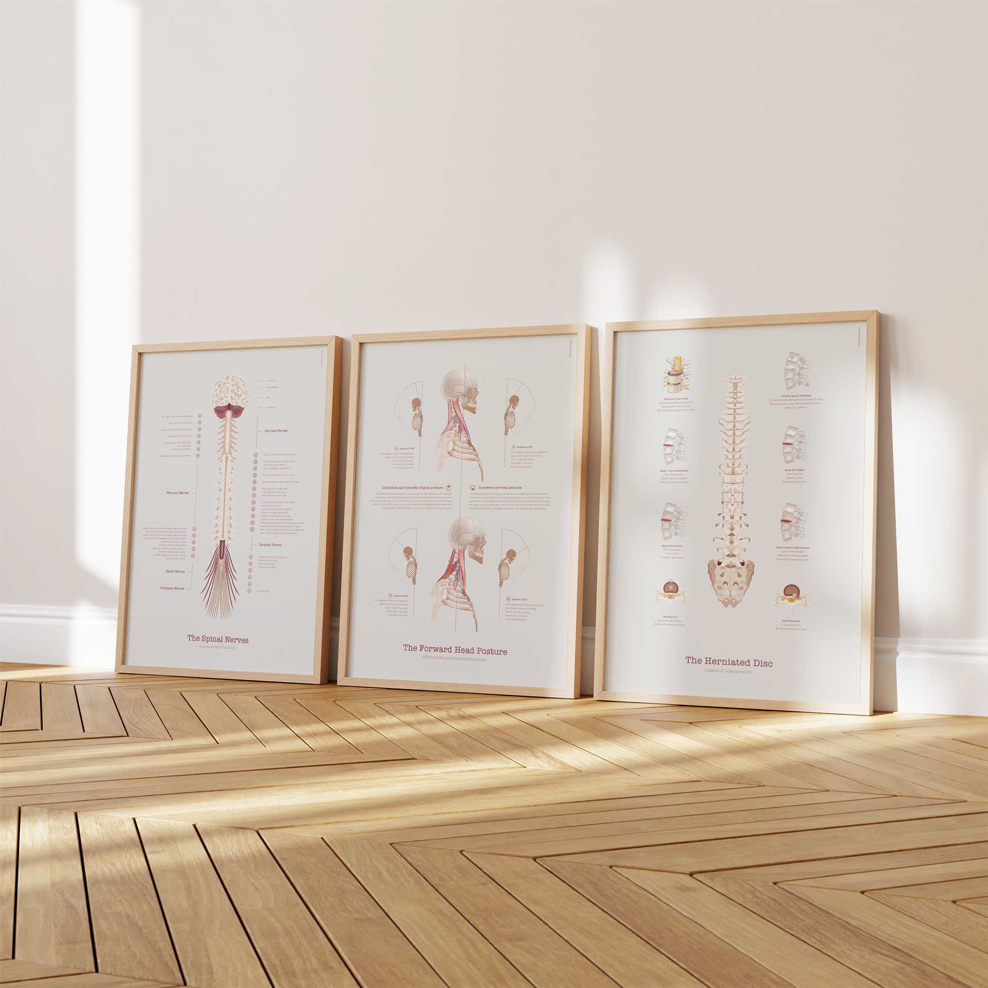 Forward Head Posture chart