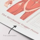 The Myofascial Trigger Points Set anatomy chart for clinics