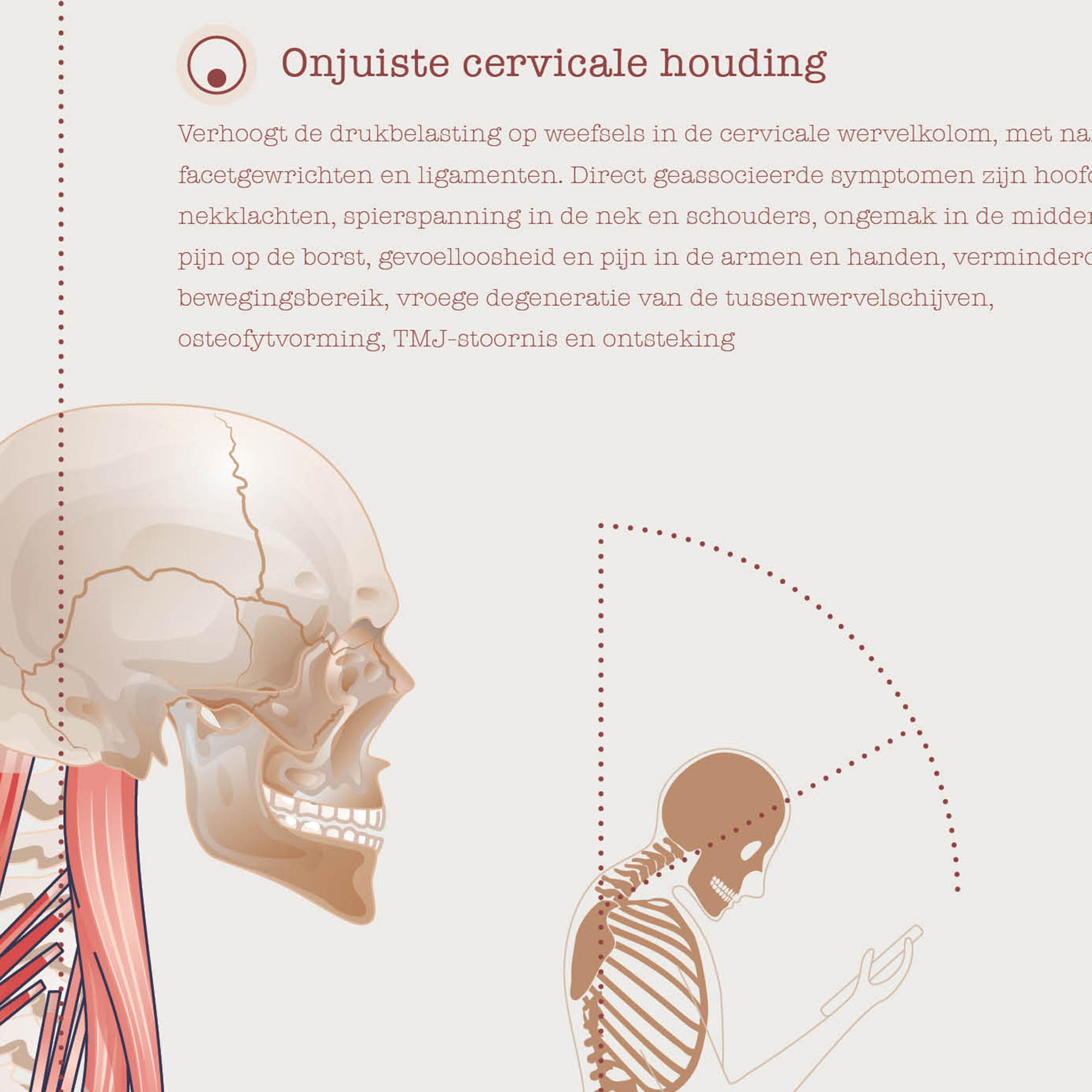 Forward Head Posture and Statistics