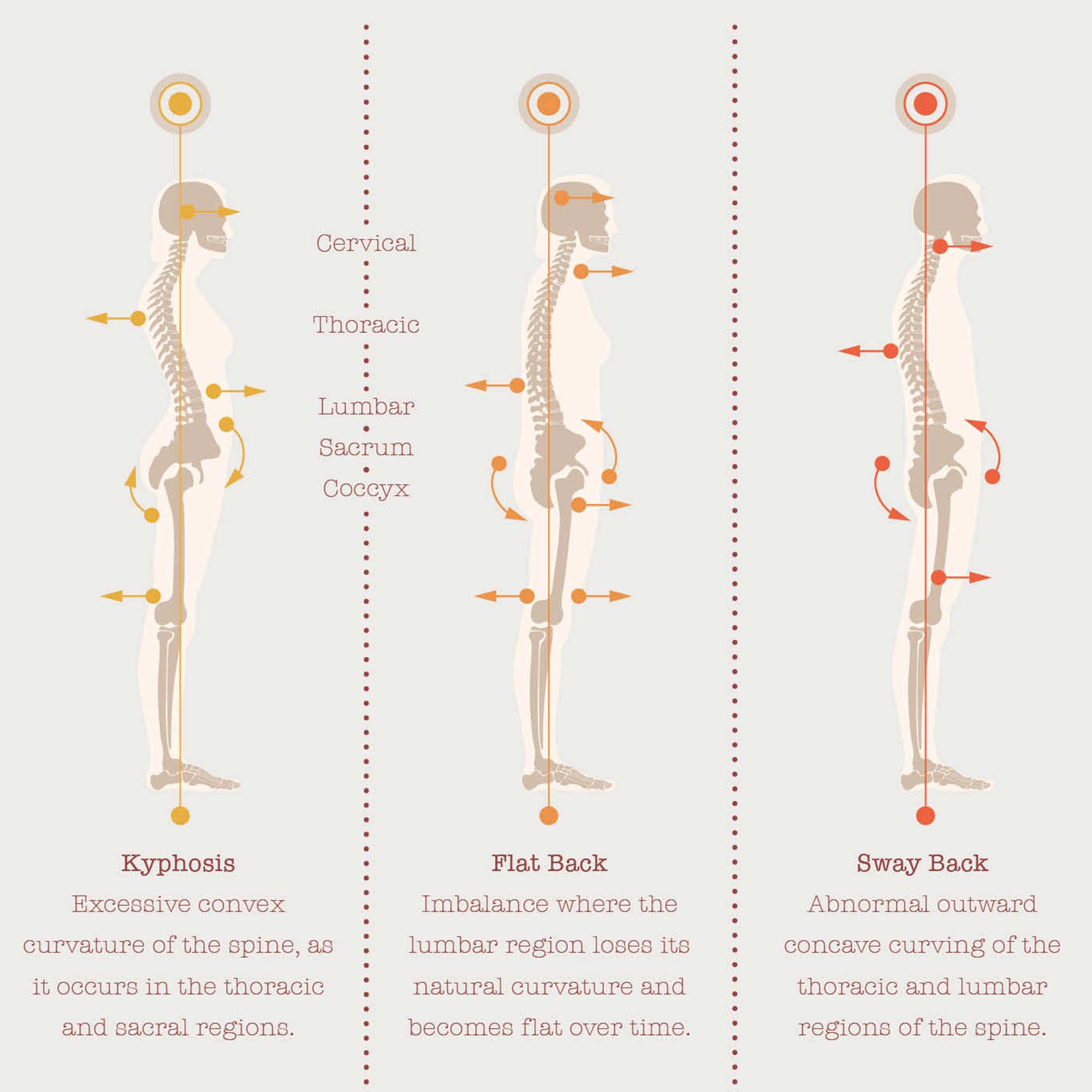 The Posture Poster