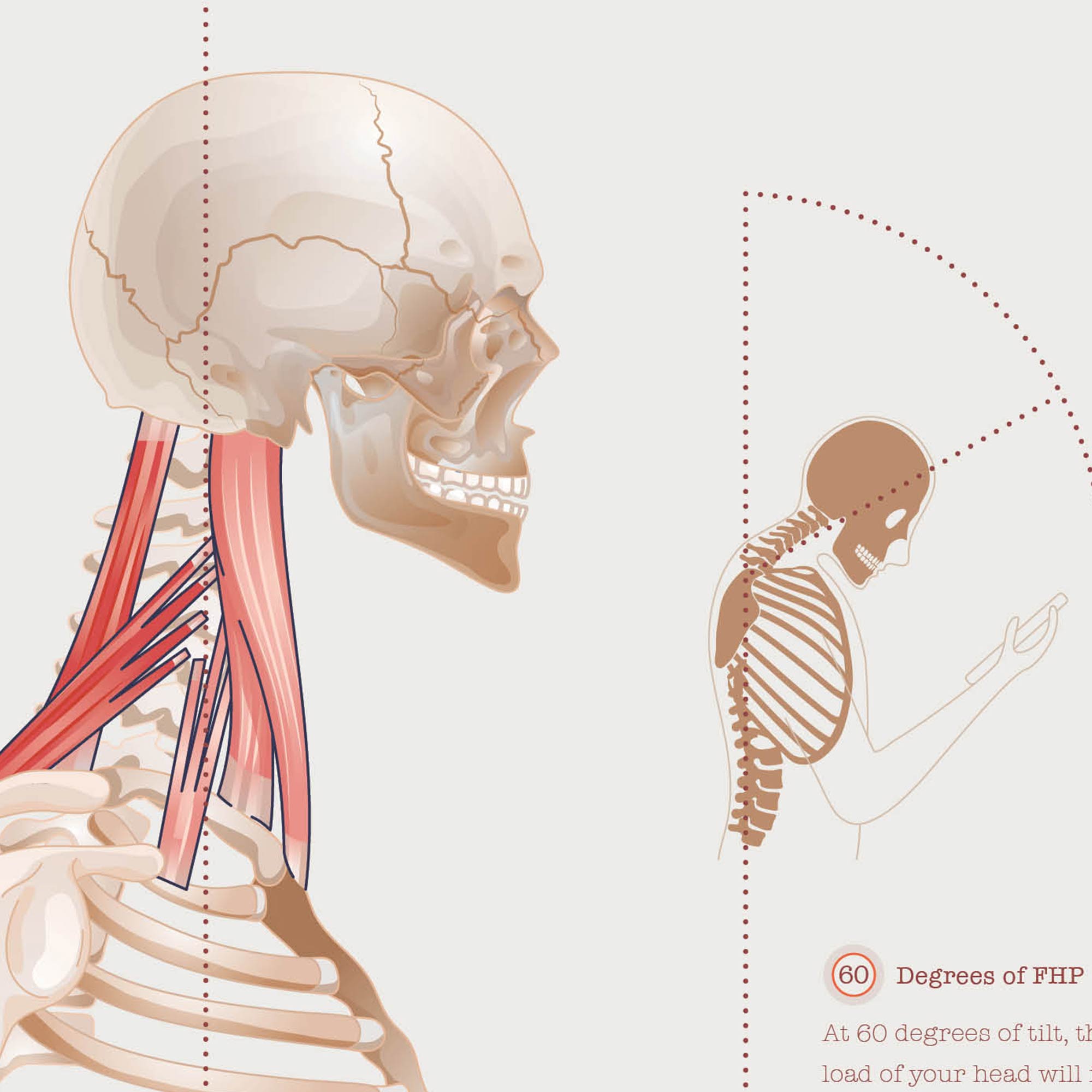 Forward Head Posture chart