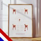 Stages of Tooth Decay