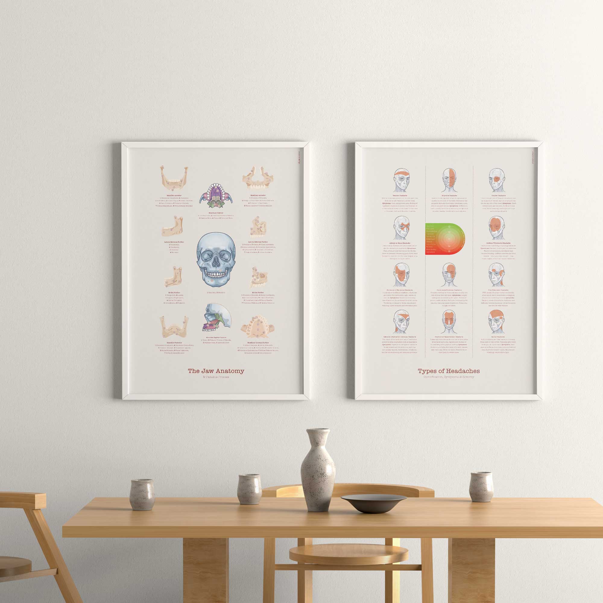 Types of Headaches Chart