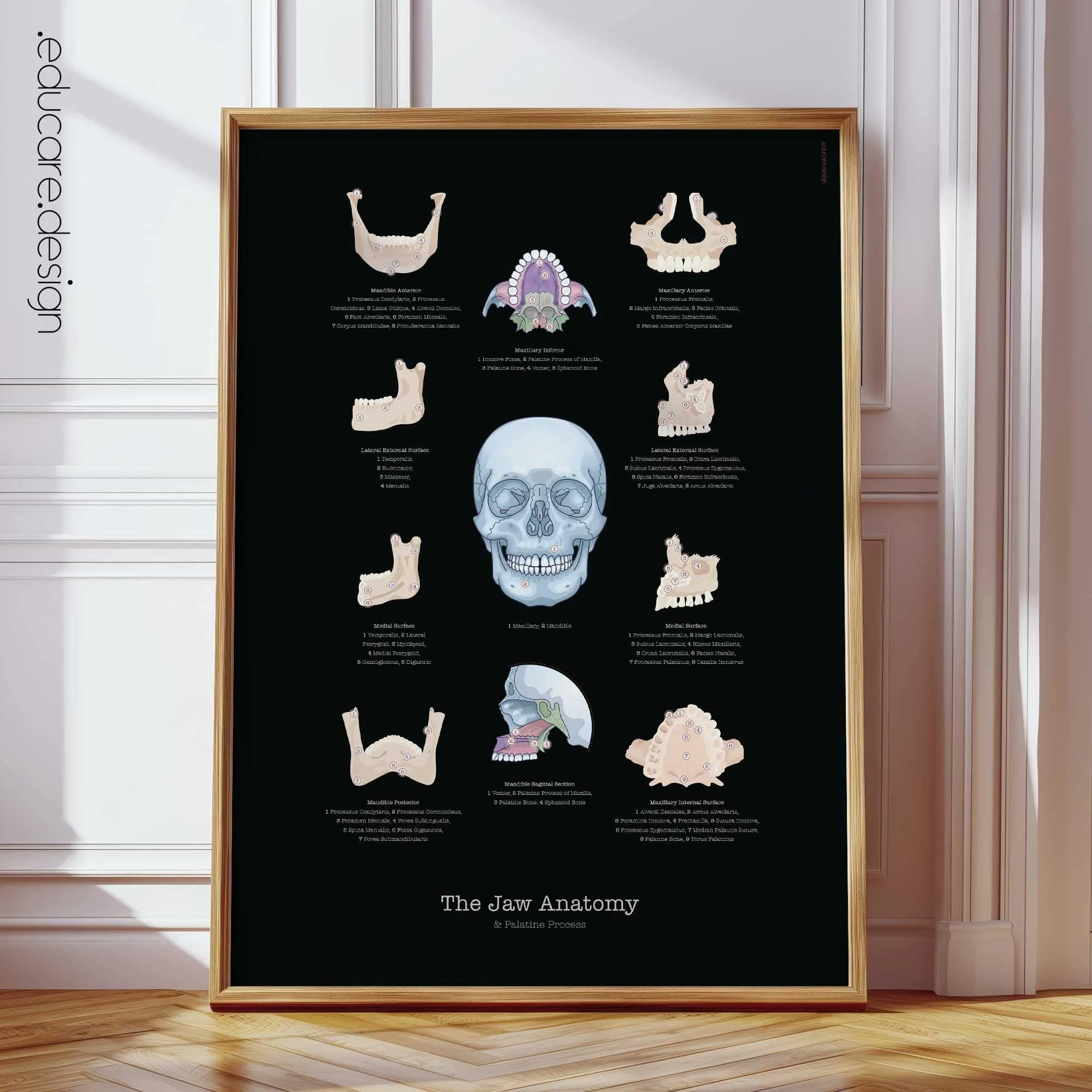 TMJ Disorder anatomy chart for clinics TMJ Disorder anatomy chart for clinics