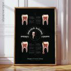 Stages of Tooth Decay Anatomy Chart, Black Edition