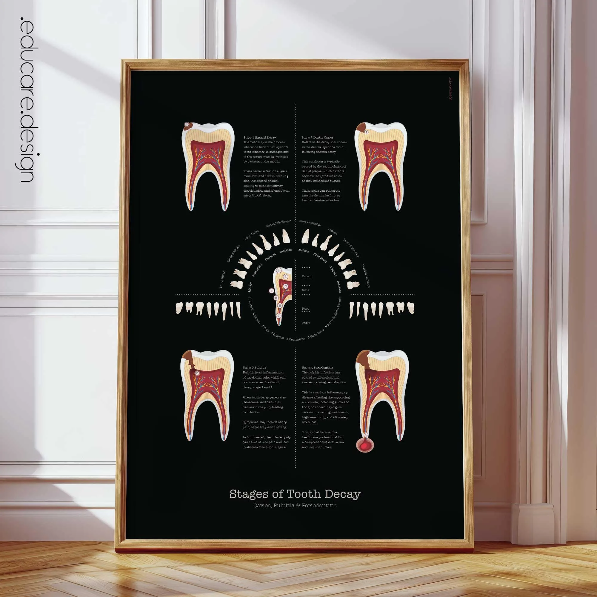 TMJ Disorder anatomy chart for clinics TMJ Disorder anatomy chart for clinics