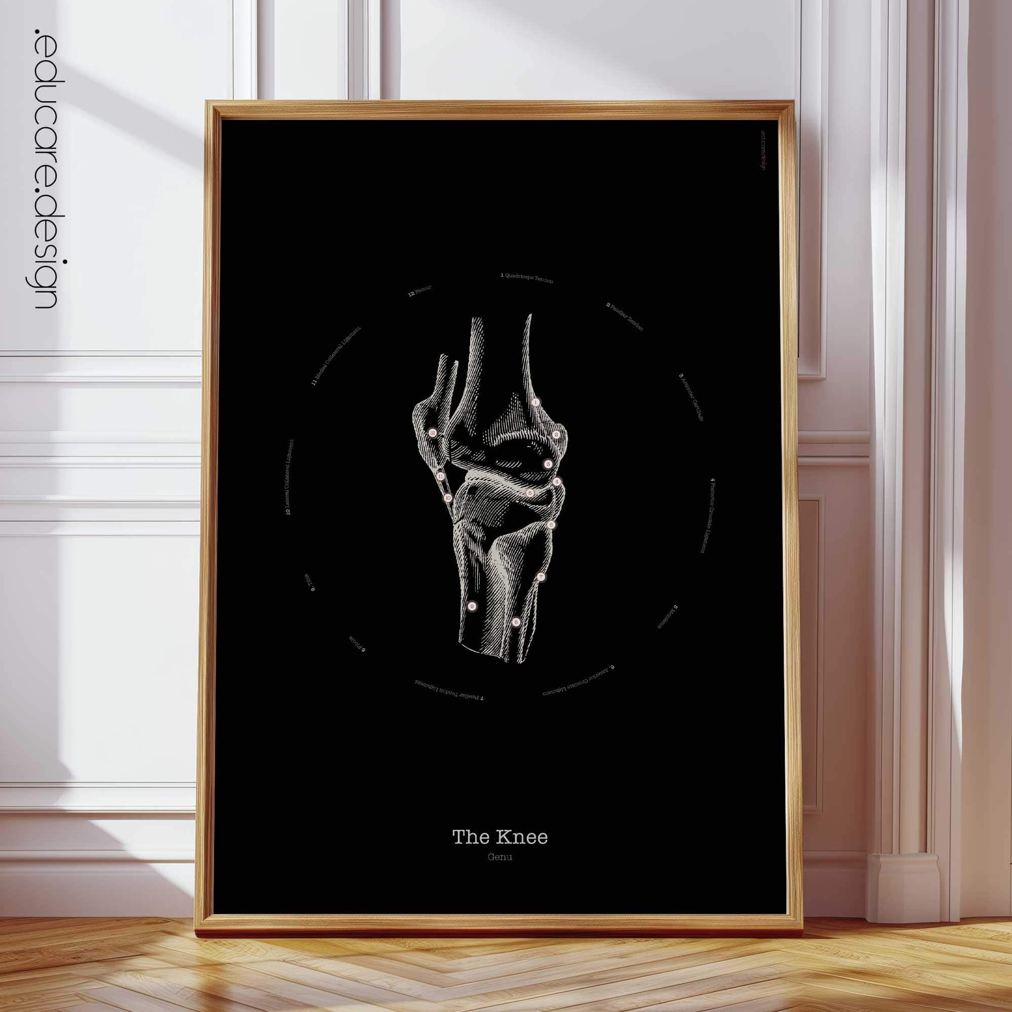 Knee Anatomy, Vintage Black Edition Chart