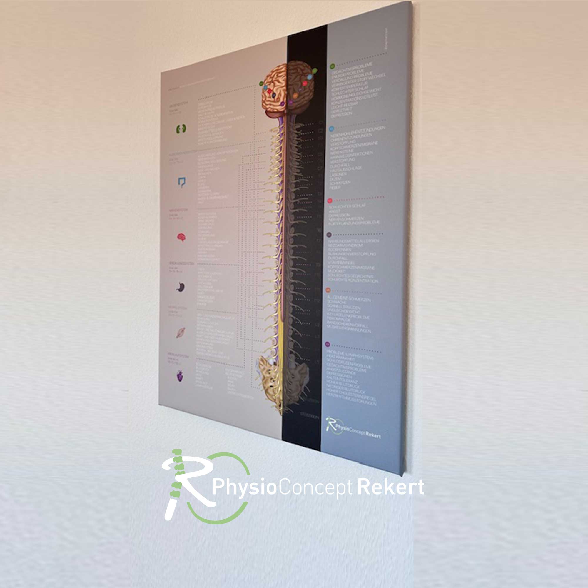 Rekert Zone Technique