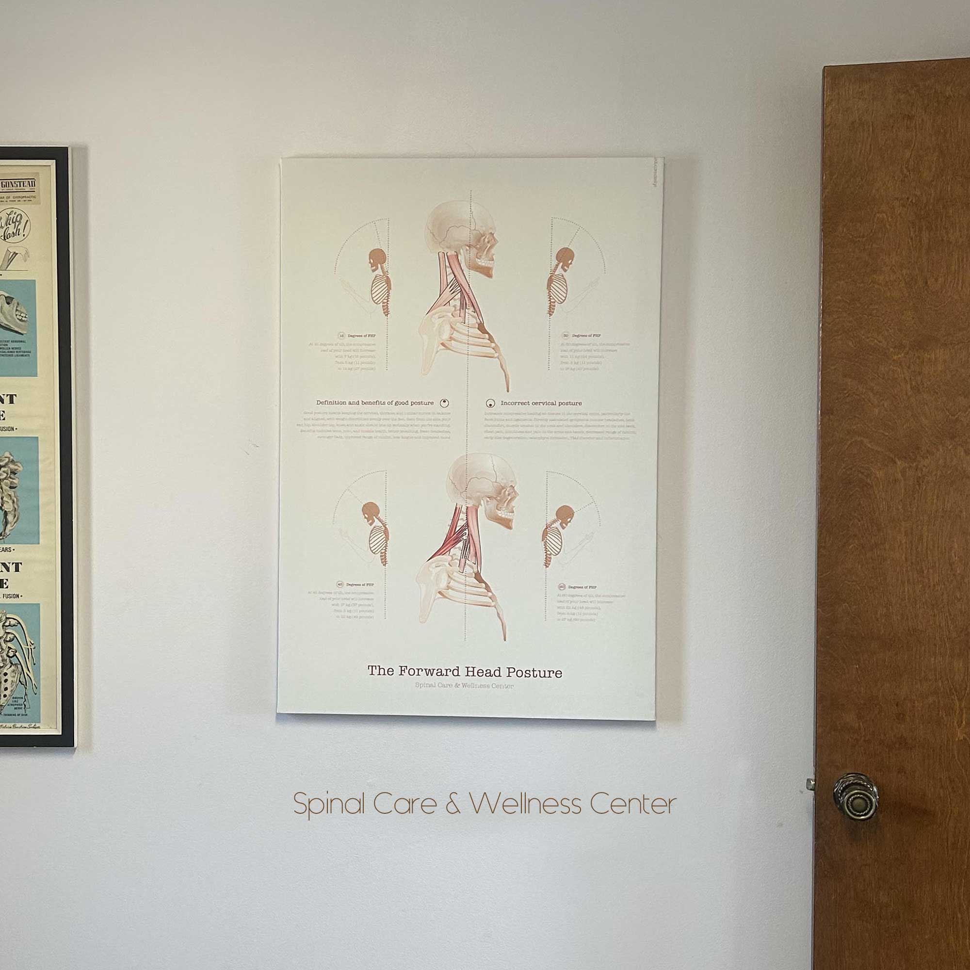 The Forward Head Posture poster