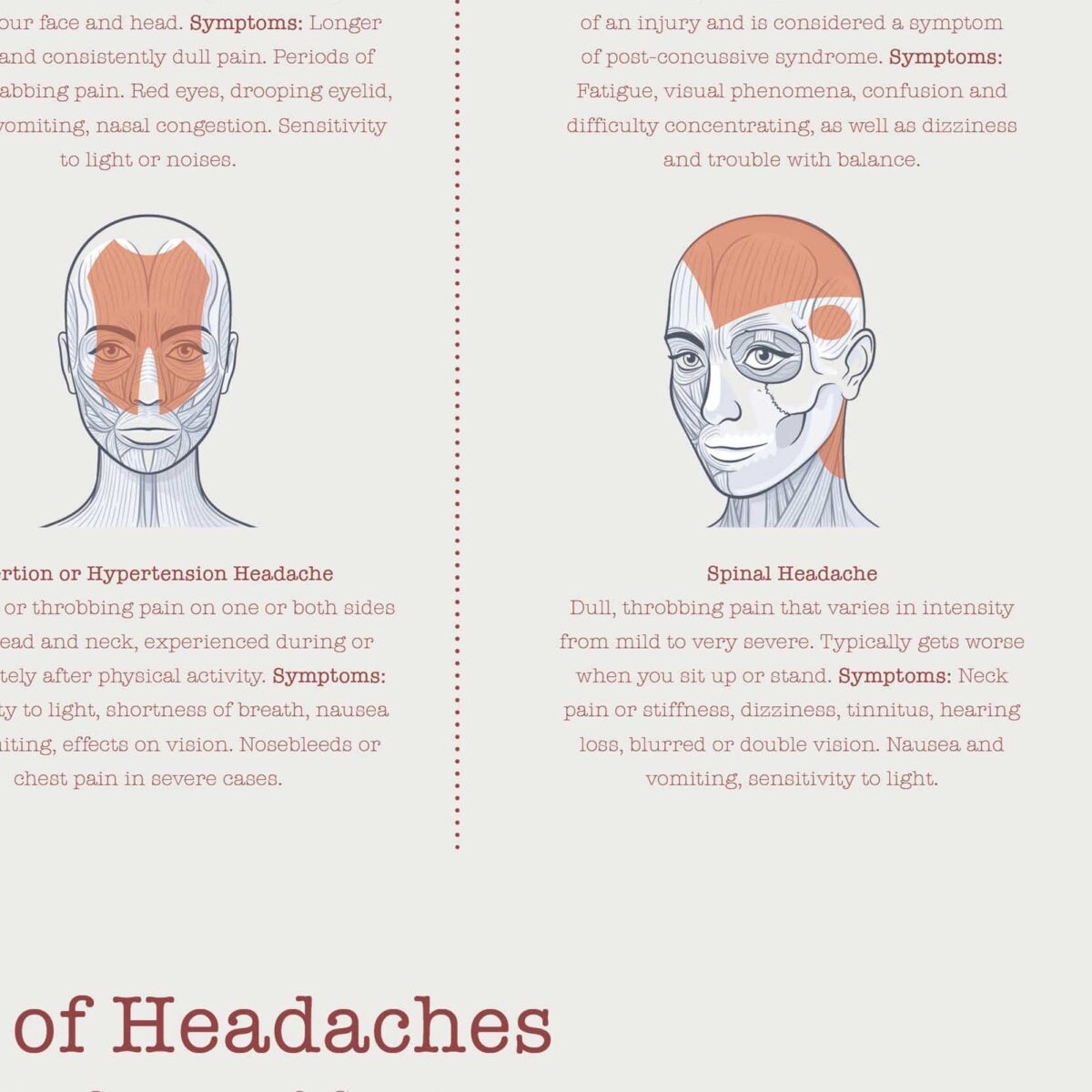 Types of Headaches Chart
