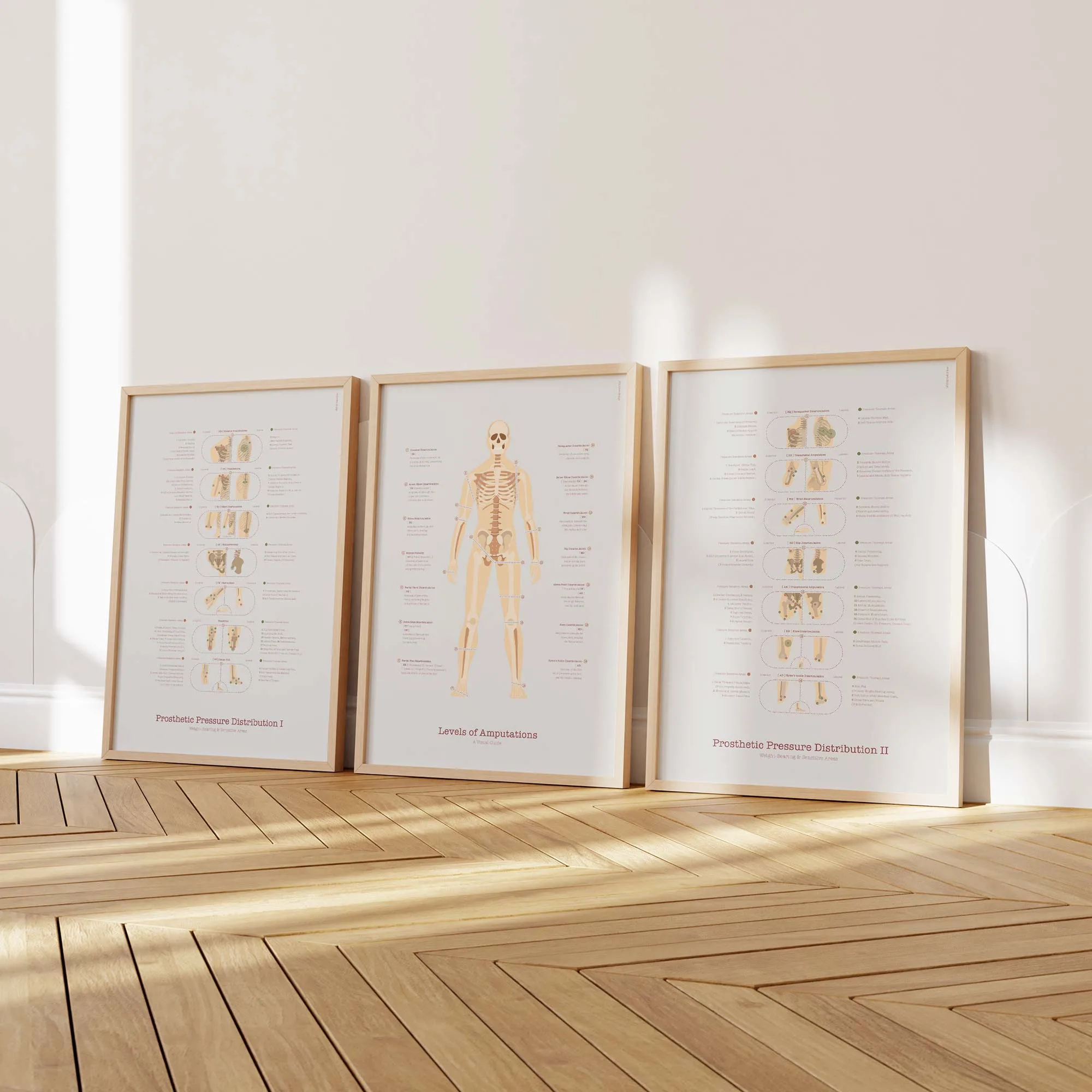 Amputations & Prosthetic Pressure Distribution