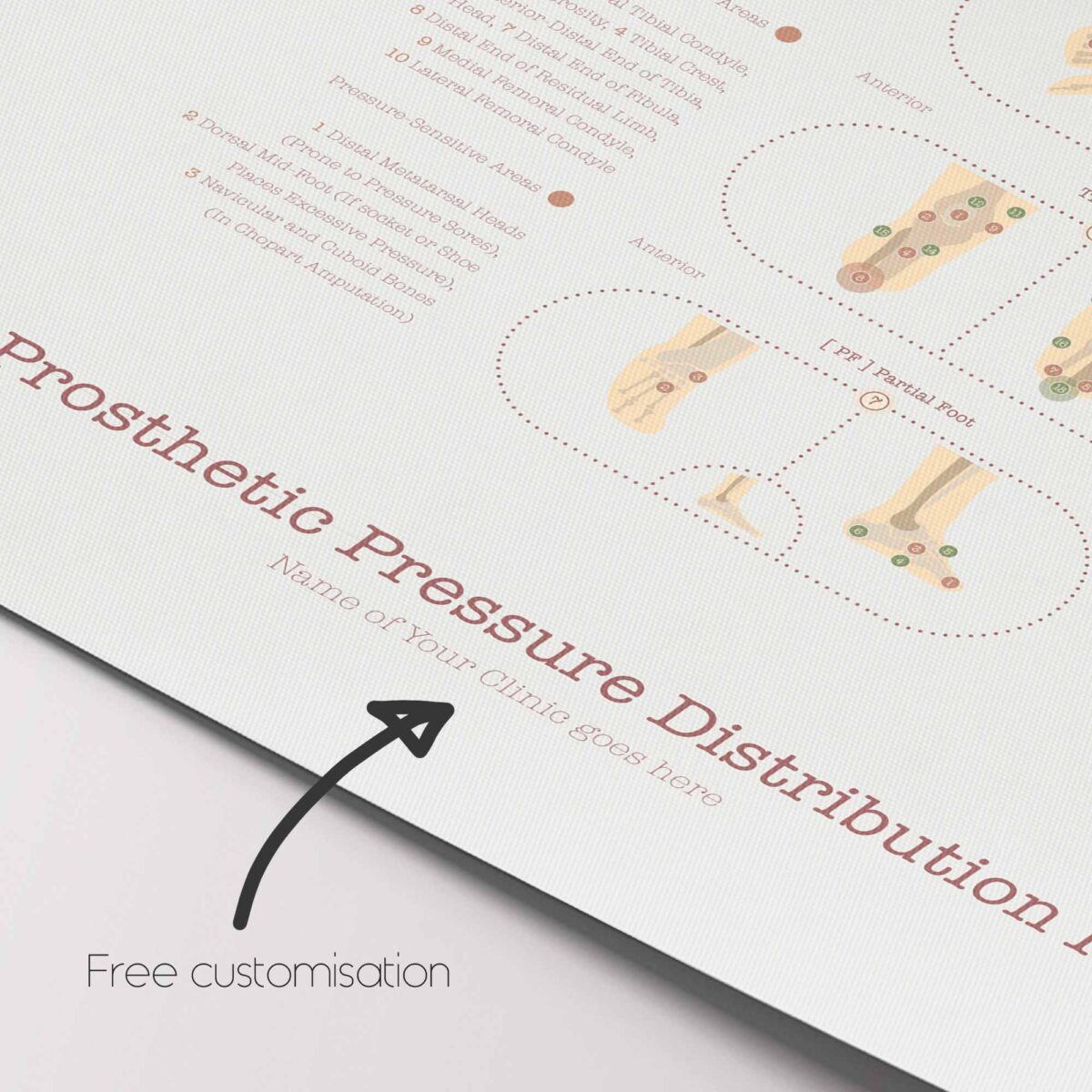 Amputations & Prosthetic Pressure Distribution