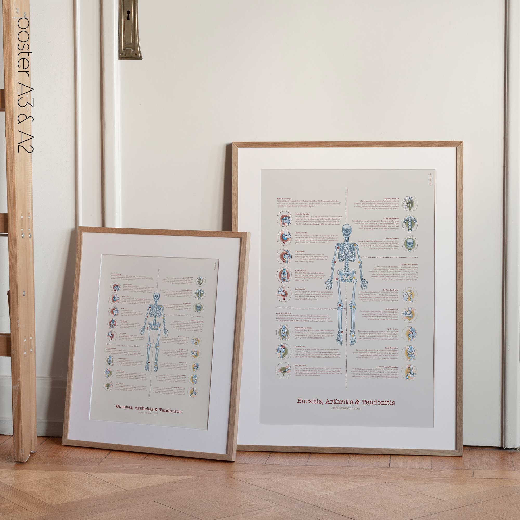 Bursitis Arthritis & Tendonitis