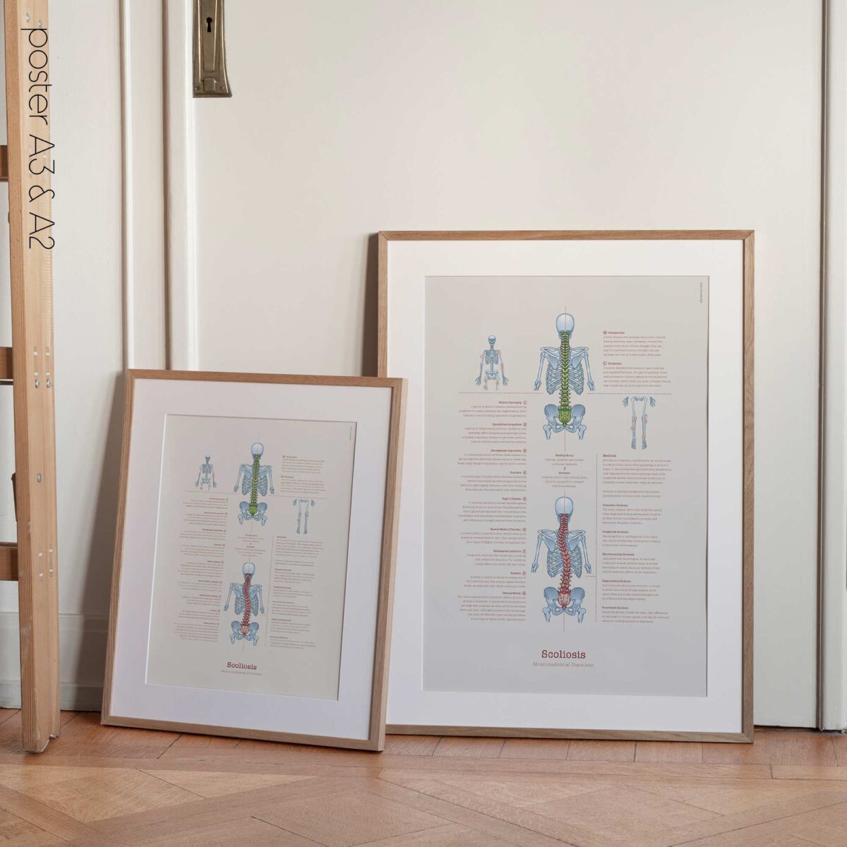 Scoliose et Troubles Musculo-Squelettiques