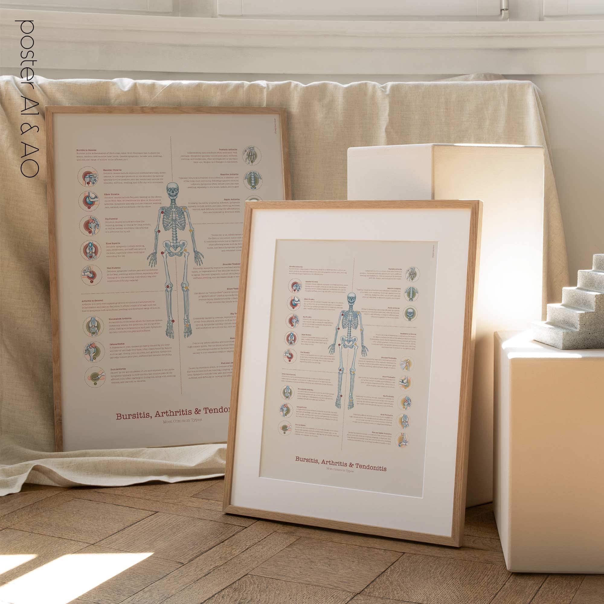 Bursitis Arthritis & Tendonitis