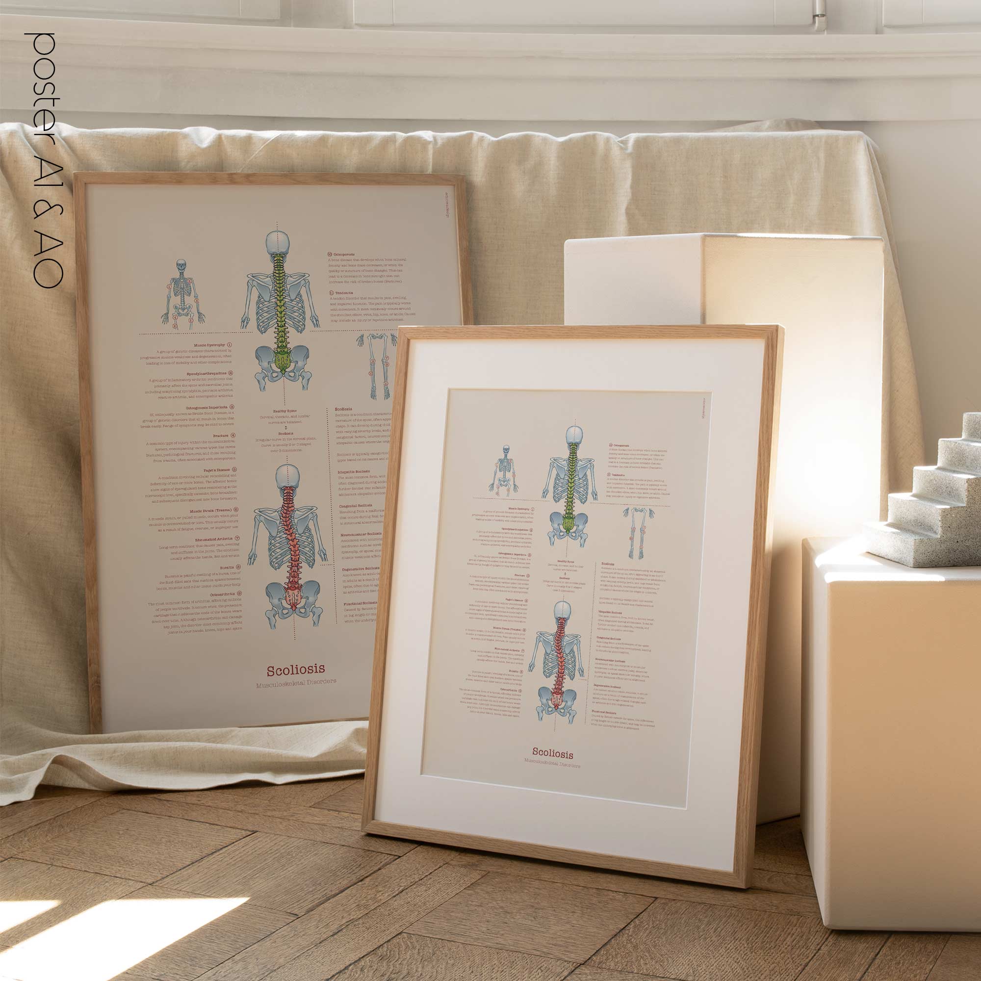 Scoliosis & Musculoskeletal Disorders