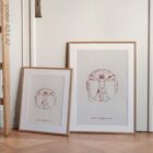 Vetruvian Amputee. Levels of amputations.