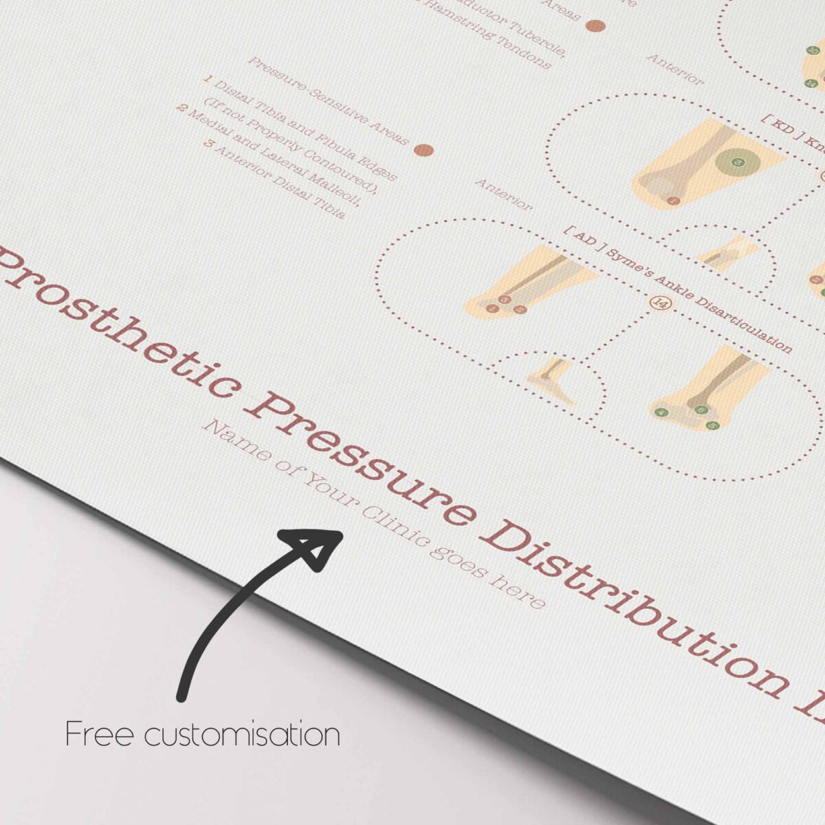 Amputations & Prosthetic Pressure Distribution