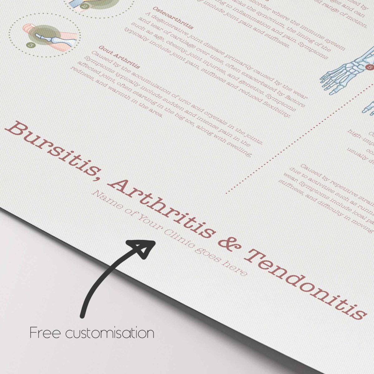 Bursitis Arthritis & Tendonitis