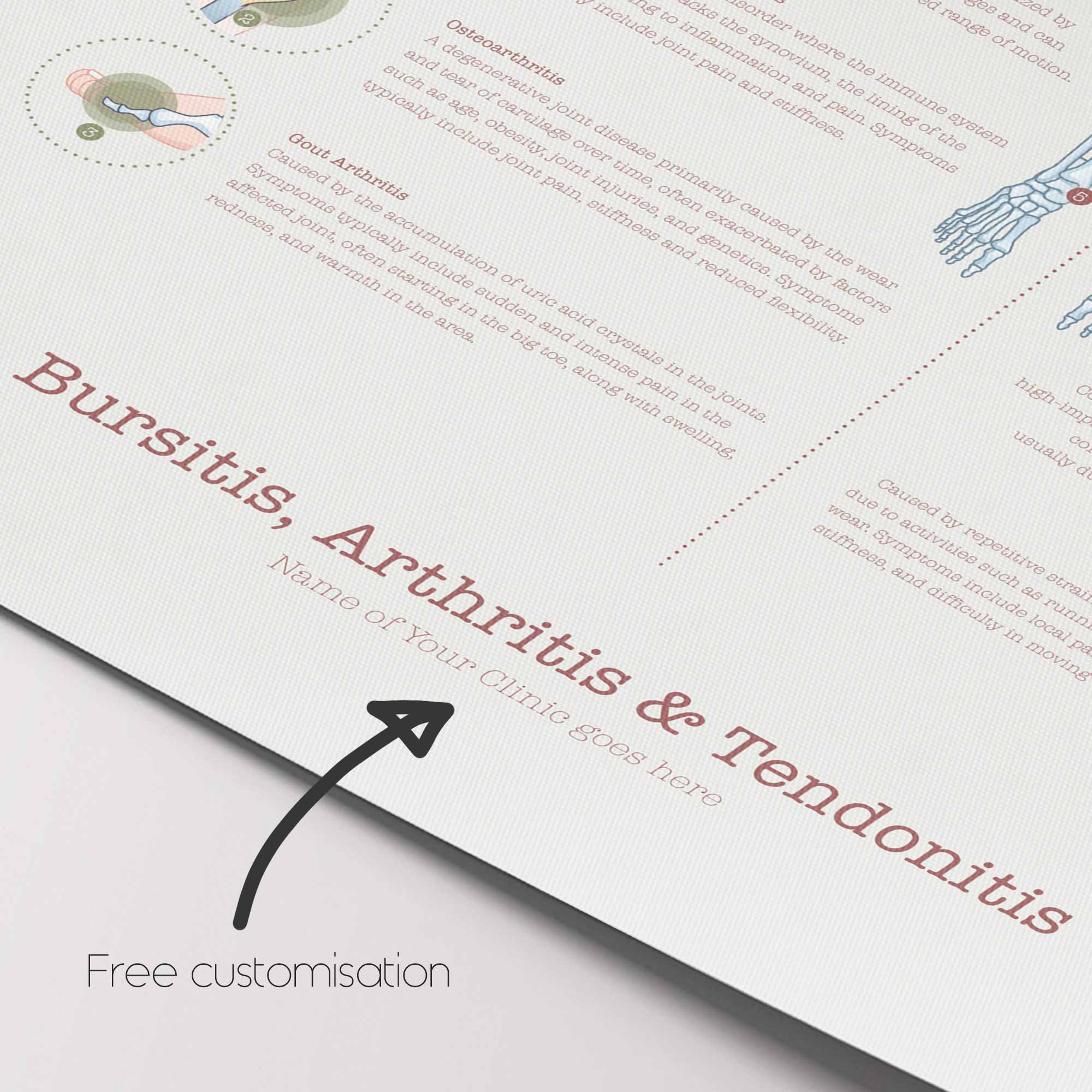 Bursitis Arthritis & Tendonitis