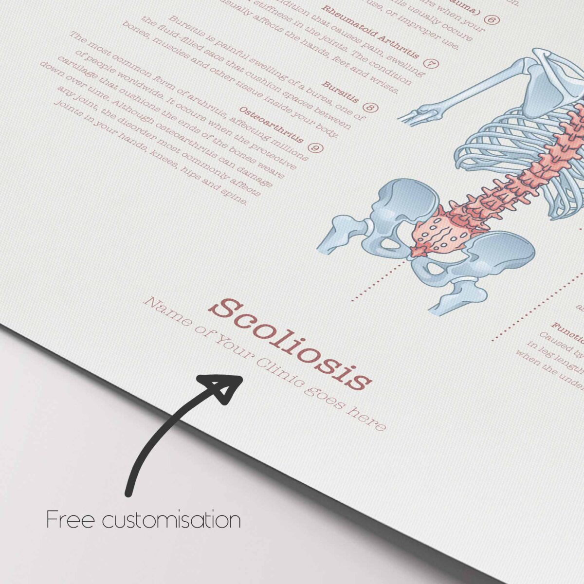 Scoliose et Troubles Musculo-Squelettiques