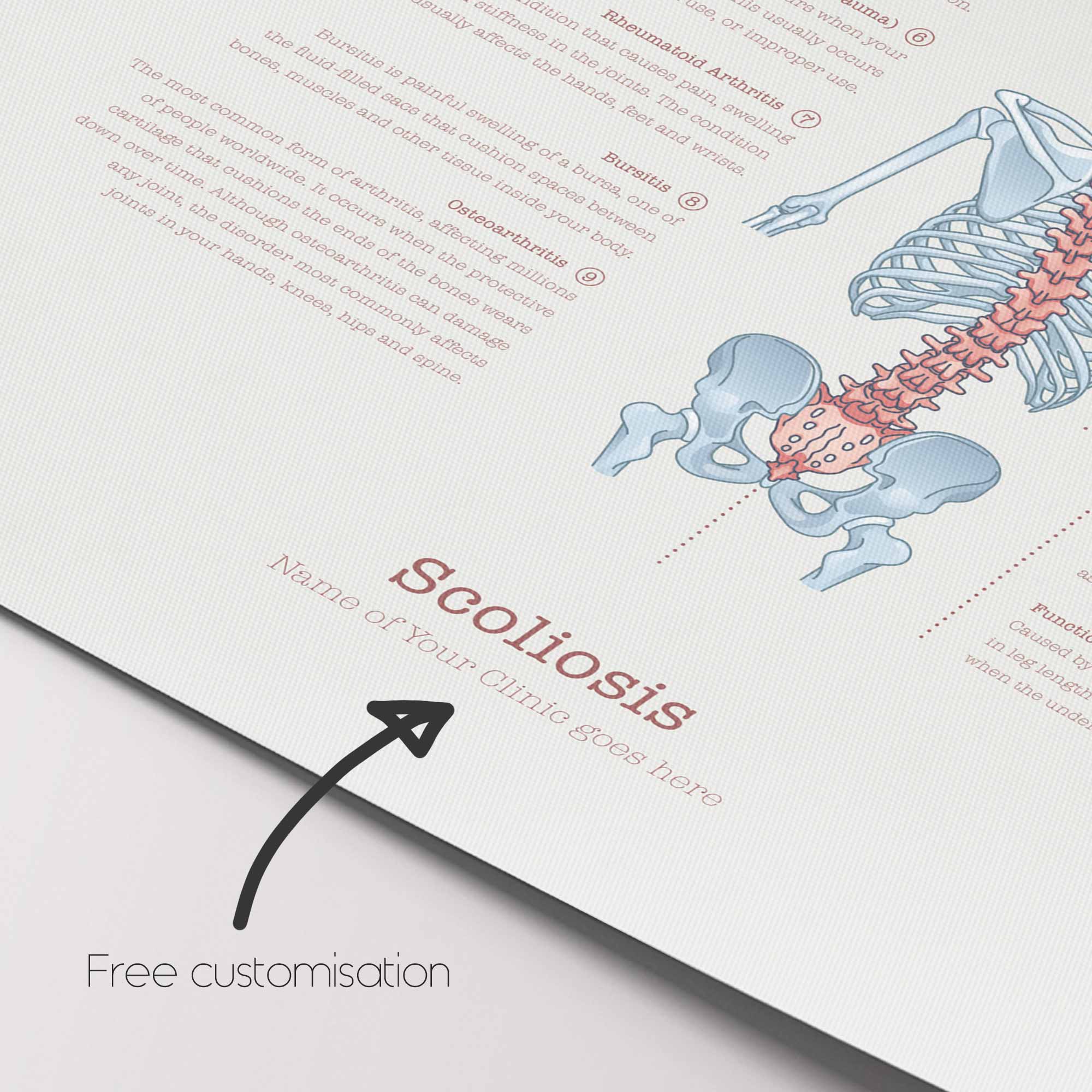 Scoliosis & Musculoskeletal Disorders