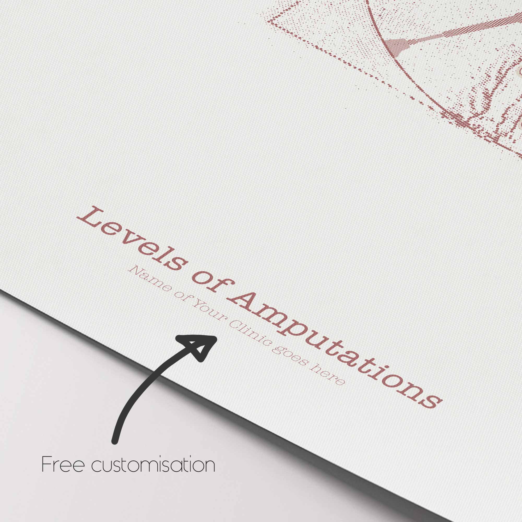 Vetruvian Amputee. Levels of amputations.