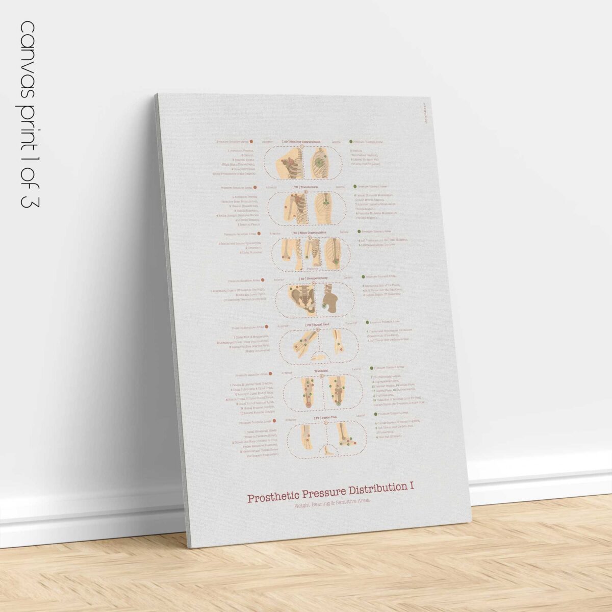Amputations & Prosthetic Pressure Distribution