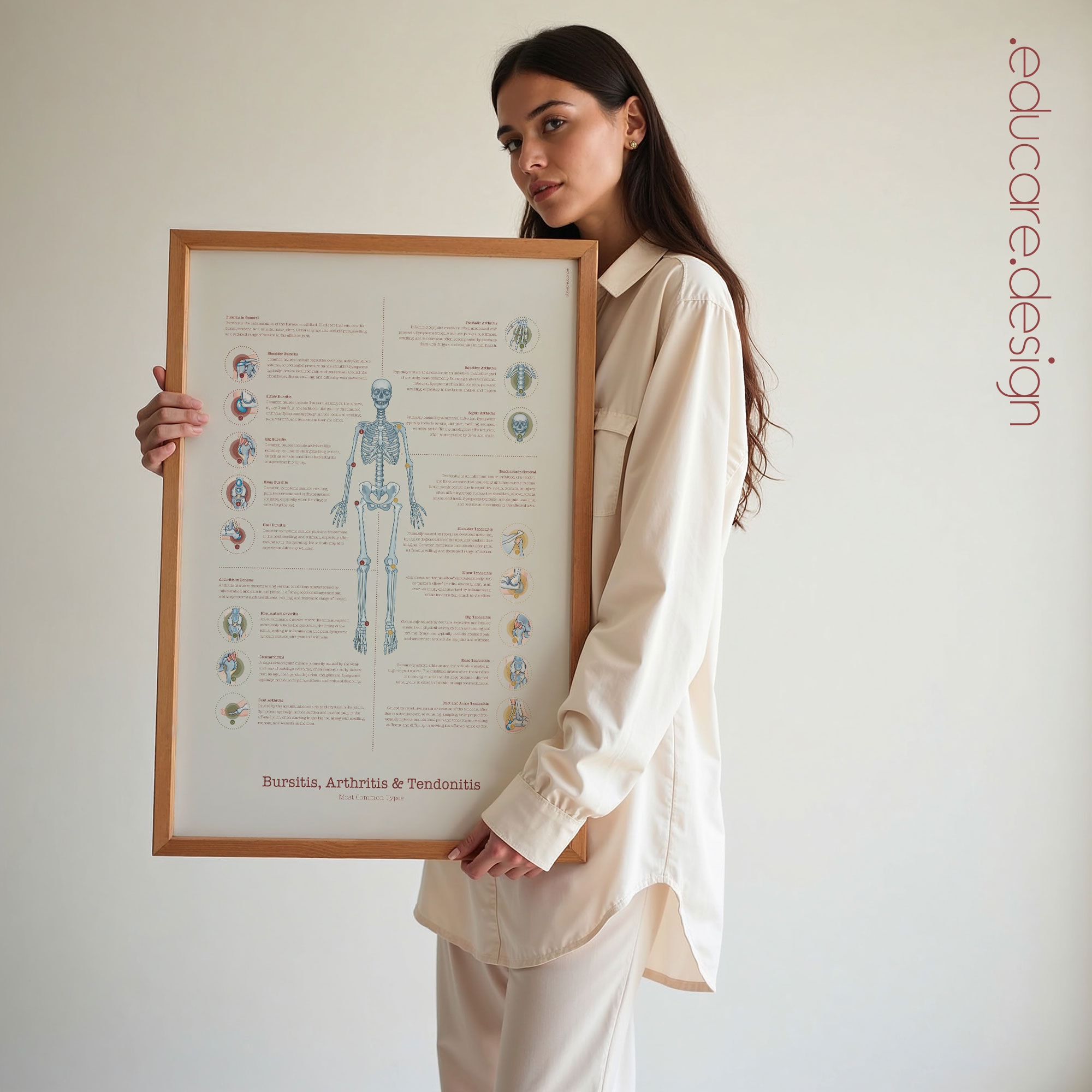 Bursitis Arthritis & Tendonitis