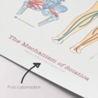 Mechanism of Sciatica – educare.design Sciatica with Stenosis, Hernia & Piriformis Syndrome