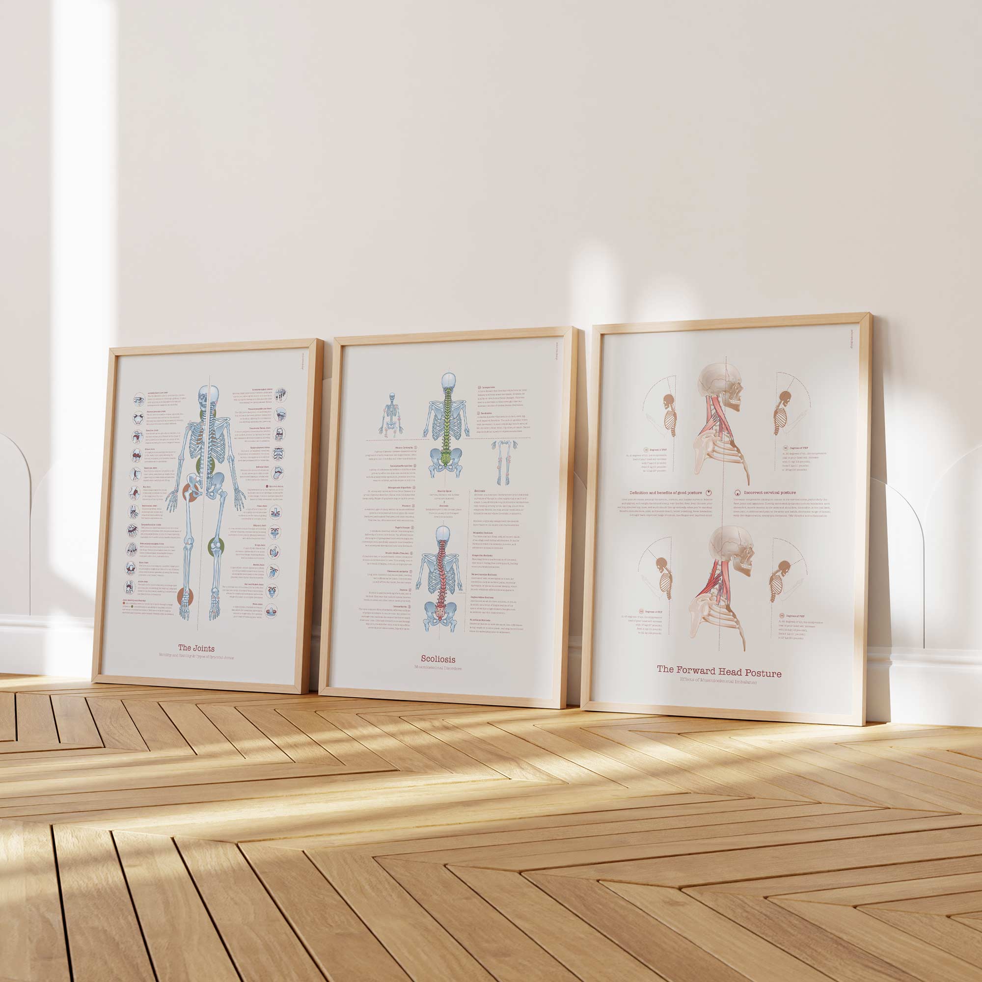 Scoliosis & Musculoskeletal Disorders