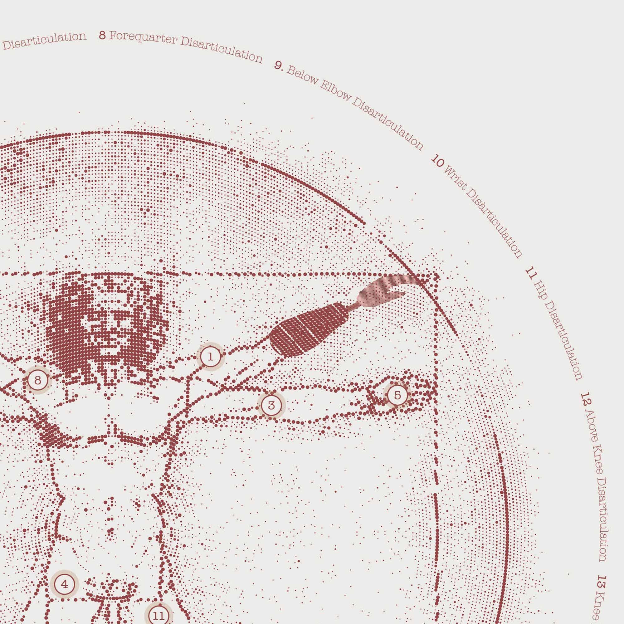 Vetruvian Amputee. Levels of amputations.