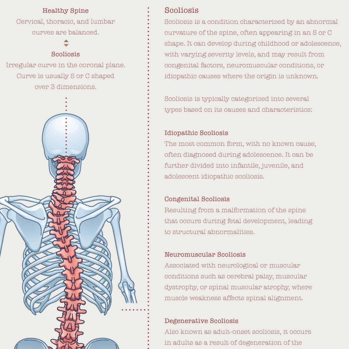 Scoliose et Troubles Musculo-Squelettiques