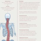 Scoliosis and Musculoskeletal Disorders – educare.design Scoliosis & Musculoskeletal Disorders