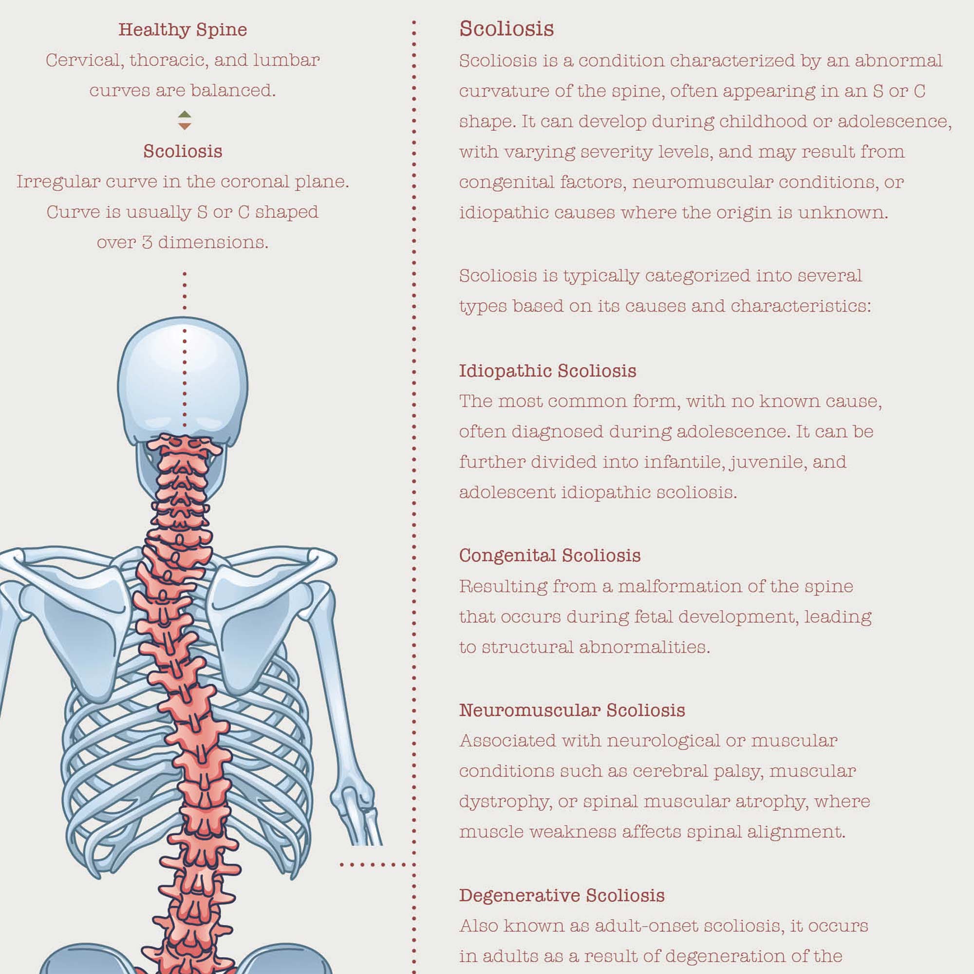 Scoliosis & Musculoskeletal Disorders