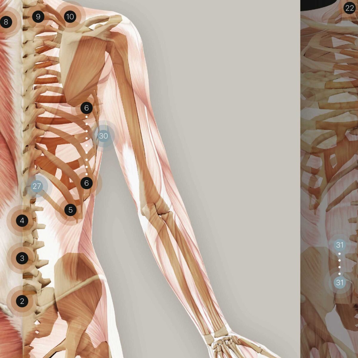 PRRT: NociceptivExam™ in Un Minuto