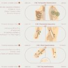 Amputations and Prosthetic Pressure Distribution anatomy chart for clinics