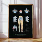 Mechanism of Sciatica – educare.design Sciatica Anatomy Chart, Black Edition