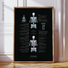 Scoliosis and Musculoskeletal Disorders – educare.design Scoliosis Anatomy Chart, Black Edition