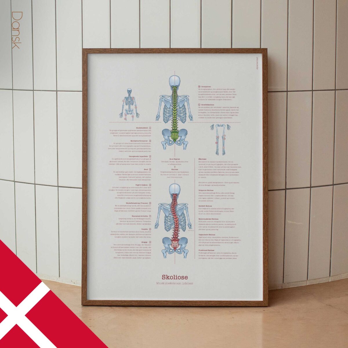 Scoliose et Troubles Musculo-Squelettiques
