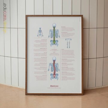 Bursitis, Arthritis und Tendinitis Anatomie-Chart für Praxen und Kliniken