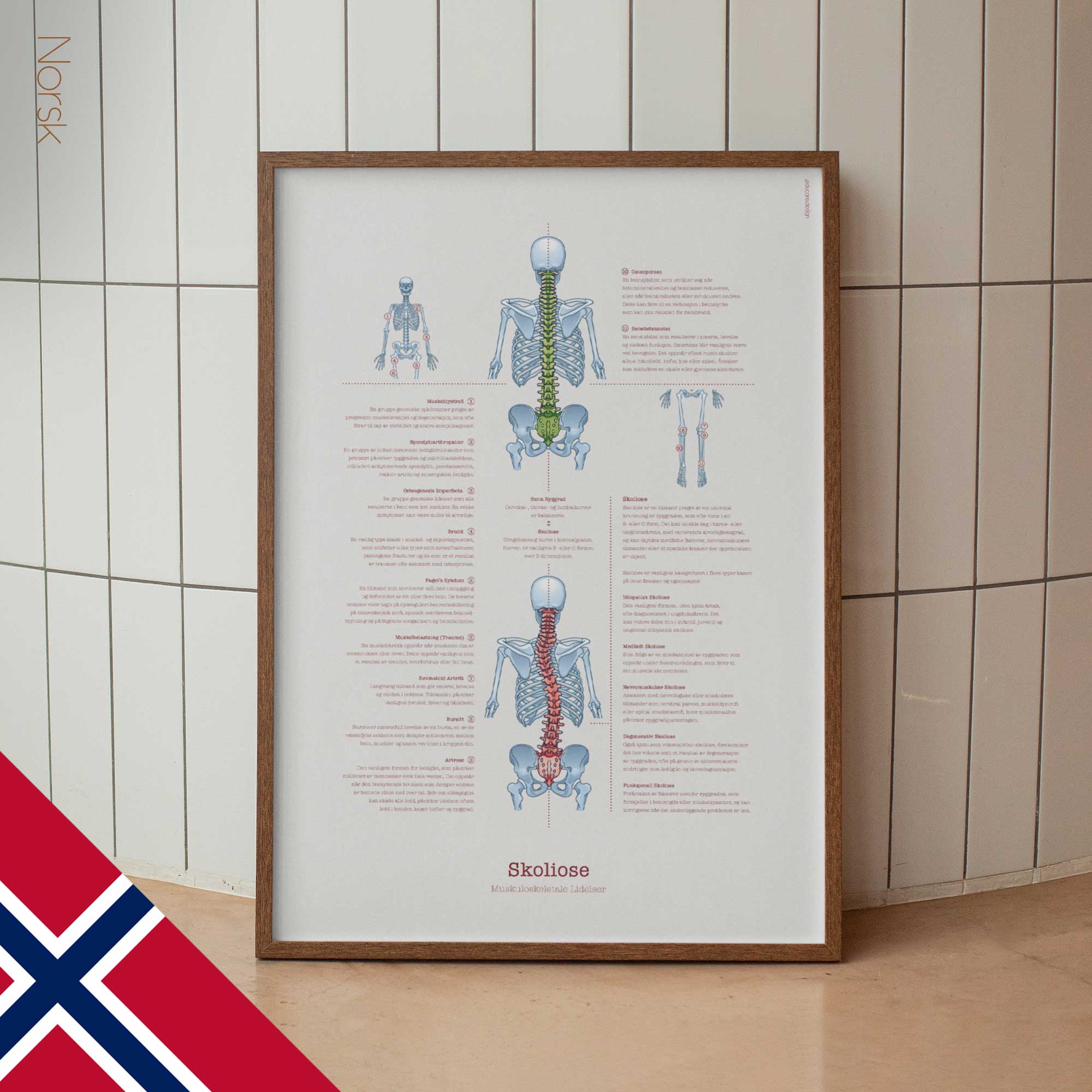 Scoliosis & Musculoskeletal Disorders