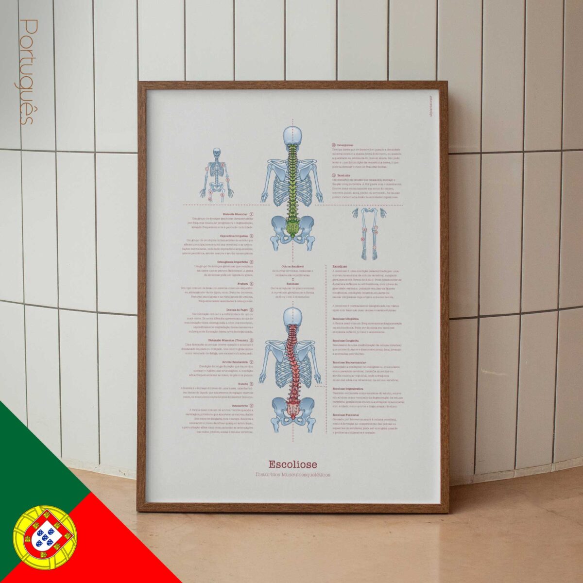 Scoliose et Troubles Musculo-Squelettiques