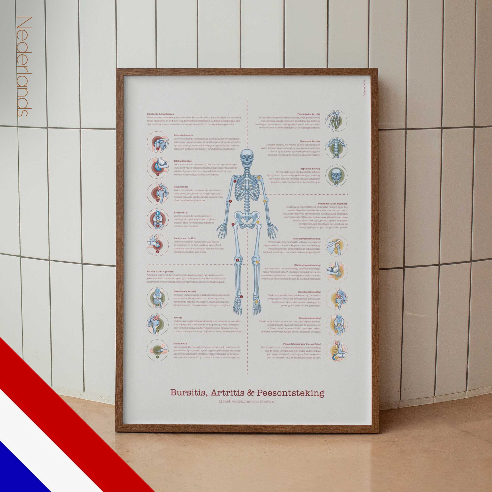 dutch Bursitis Arthritis and Tendonitis