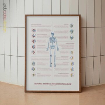 Schleimbeutelentzündung, Arthritis und Sehnenentzündung