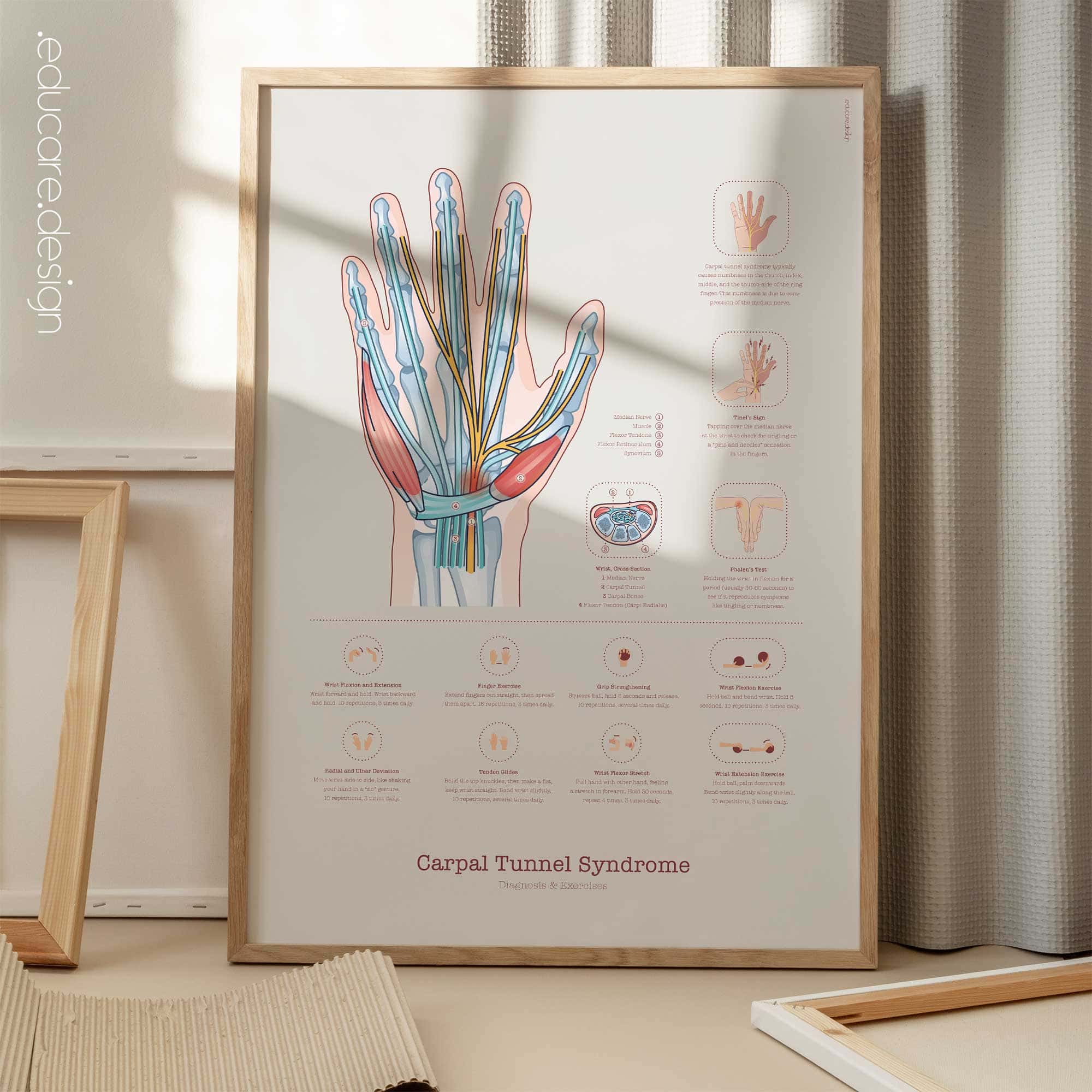 Carpal Tunnel Syndrome with Diagnosis and Exercises