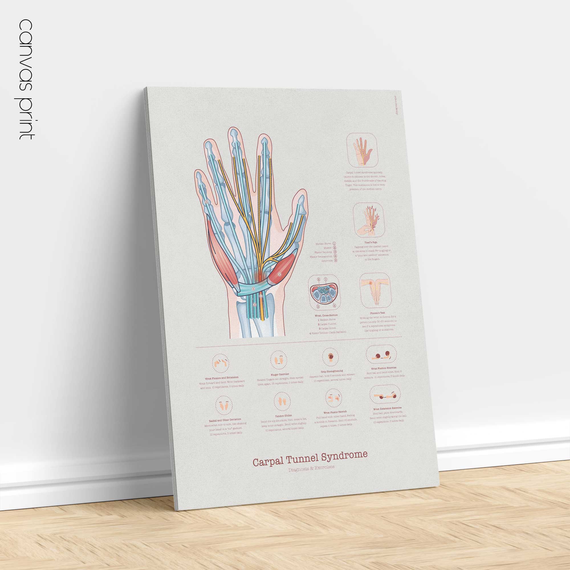 Carpal Tunnel Syndrome with Diagnosis and Exercises