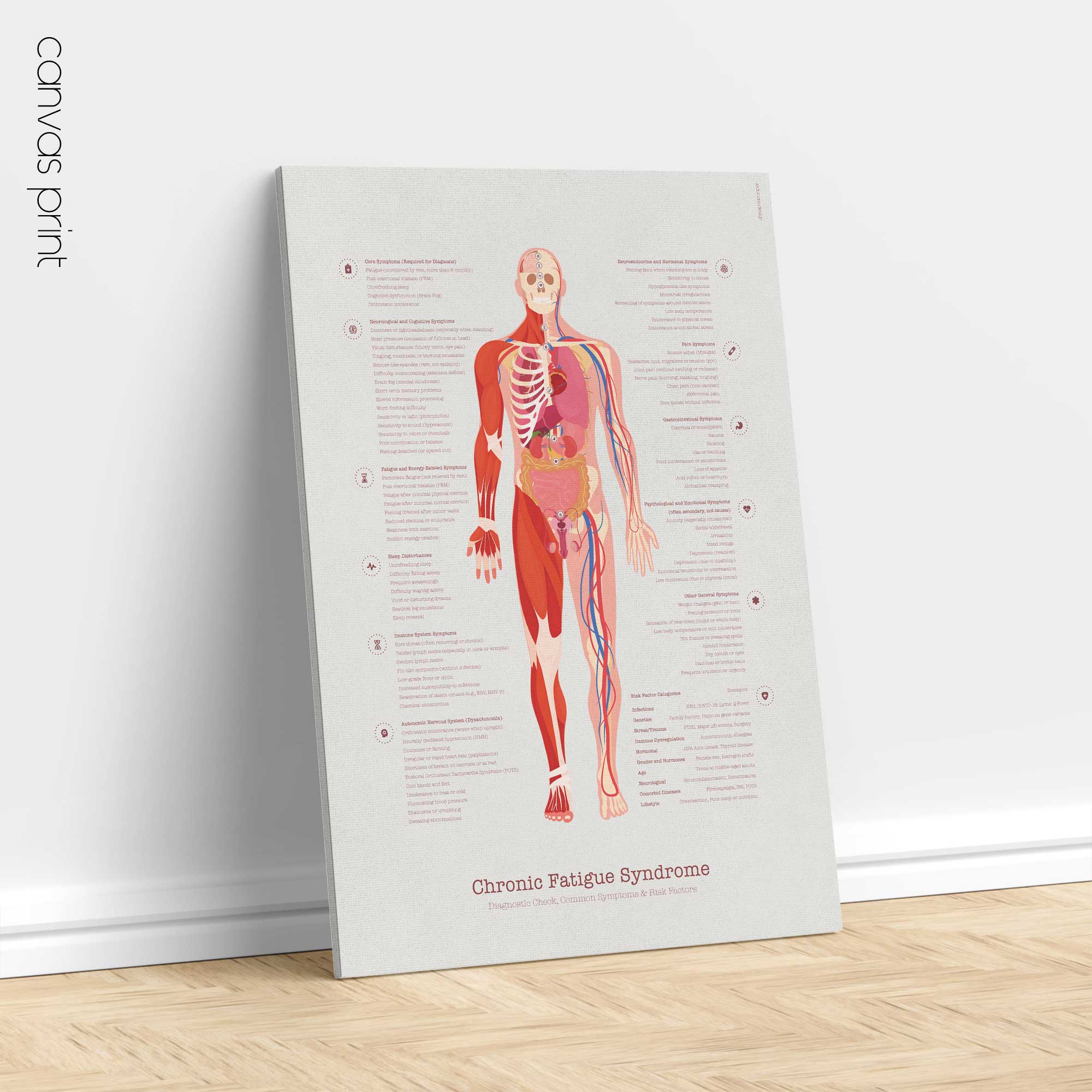 Chronic Fatigue Sindrome chart with Diagnostic Check, Common Symptoms & Risk Factors