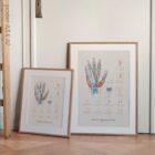 Carpal Tunnel Syndrome with Diagnosis and Exercises