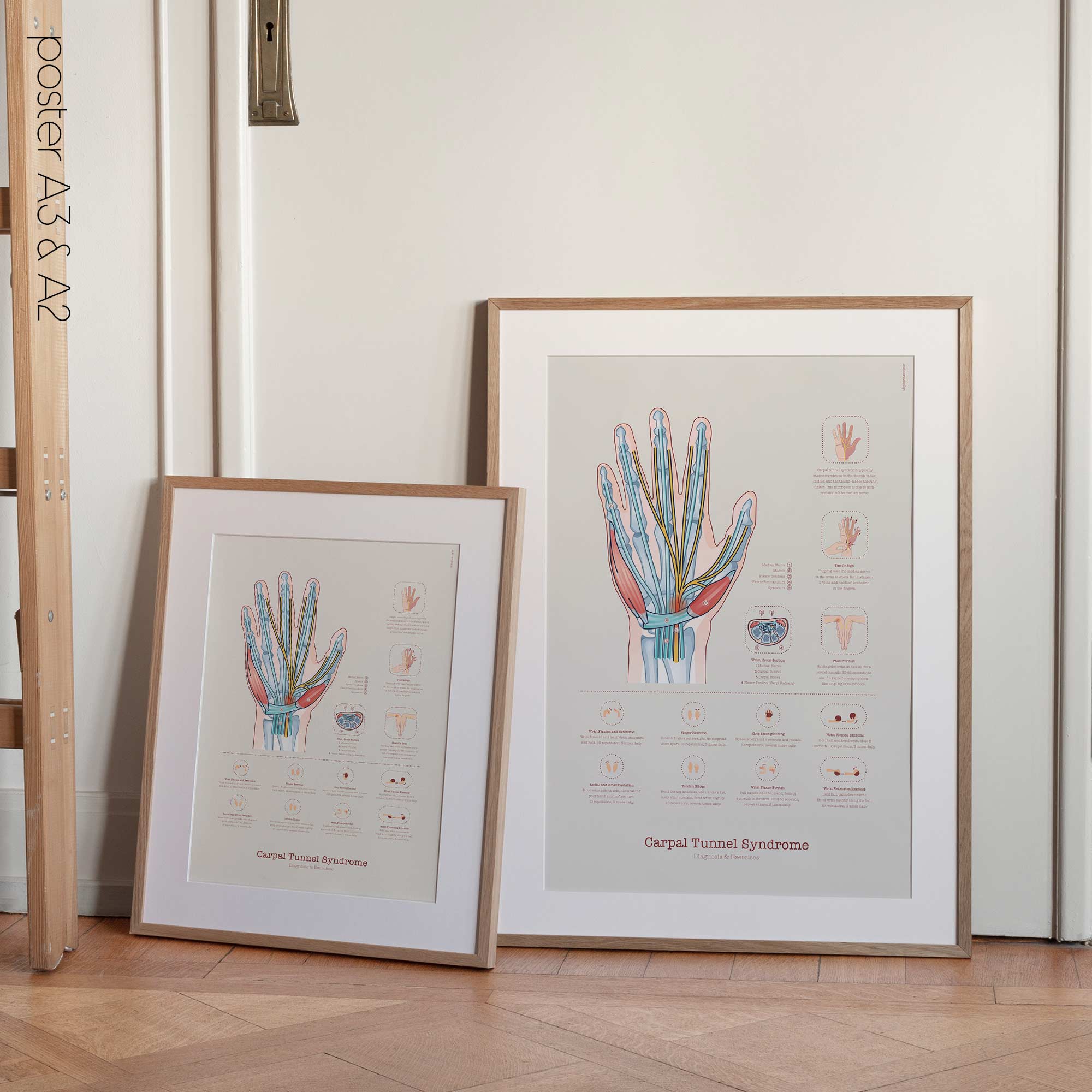 Carpal Tunnel Syndrome with Diagnosis and Exercises